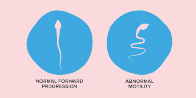 Low sperm Motility Low sperm Motility