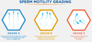 decreased sperm movement