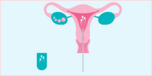 sperm transfer