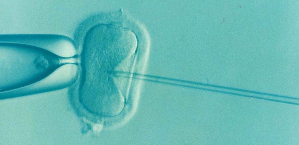Intracytoplasmic sperm injection (ICSI) Intracytoplasmic sperm injection (ICSI)