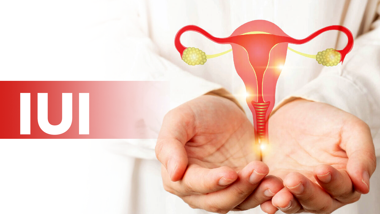 iui iui