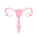 Embryo Transfer Embryo Transfer
